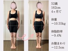 香林(KARIN)/ビフォーアフター