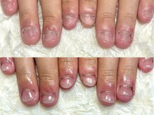 グラシナ 鳥丸店/(深爪/長さだし/フィルイン/)