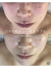 ウェリスト まこトレ整体院(WELIST)/before after