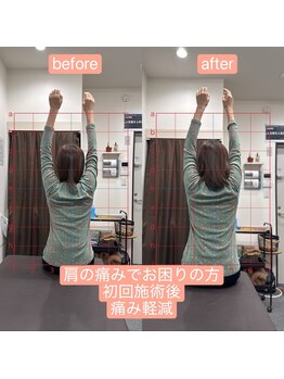 アンティオール 上野店/Before→After