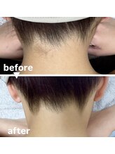 メゾン ド クロエ(Maison de Chloe)/ブライダルシェービング