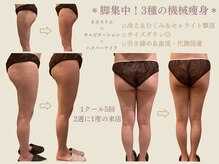 エステティックサロン アールグレー 名古屋駅店/Neoスリム～脚集中引き締め～