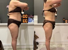 プシュケ(PSYCHE)/60代女性ビフォーアフター