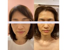 ドクターエイジレス(DR.AGELESS)の雰囲気（肌と歪みをキレイに若々しい印象へ♪もう年齢は気にしない！）