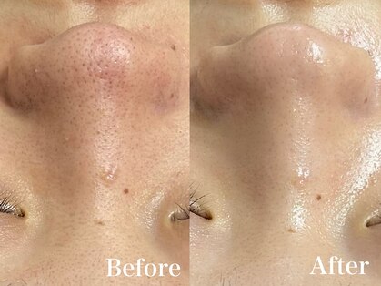 マシェ バイ マユ(Mache by Mayu)の写真