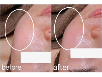 リル バイ アンドアール(Rire by and.R)/韓国美肌ワックス