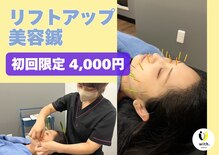 ウィズ鍼灸整骨院 十三院(with.鍼灸整骨院)