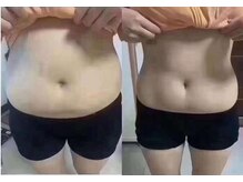 Kaetsu　痩身美容エステサロン　銀座店/むくみ取り！ウエスト-15cm