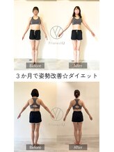 アイユー 鹿児島中央店(iU)&nbsp;ダイエット 姿勢改善