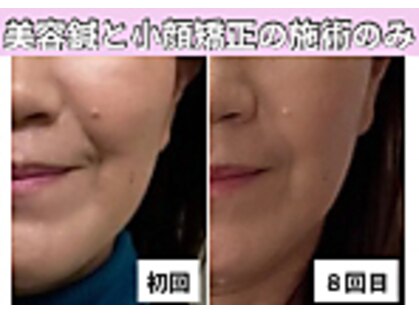 はまだ整体院の写真