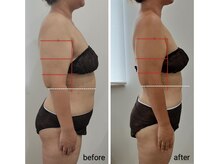 レスプロンディール(Resplendir)/