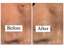 サロンドフェイス 木曽川店(Salon de Faith)/陶肌トリートメント