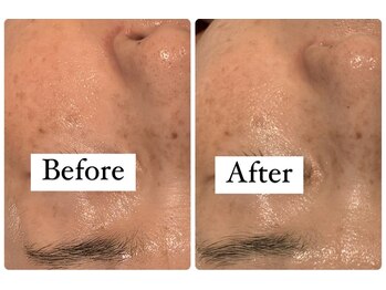 サロンドフェイス 木曽川店(Salon de Faith)/陶肌トリートメント