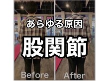 カワル整体 上通り院/その痛み、股関節からでは？