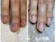 ネイルサロン Nの写真