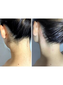 1回ごとにお支払い可能なサロン