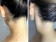 エピナス 町田店(epinus)の写真/自分では難しいうなじを綺麗に★清潔感UPで見た目も◎うなじブラジリアンワックス+美肌光脱毛(W脱毛)¥4,800