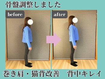 シェノン(Chainon)/骨盤調整