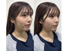 ヘッドミントVIP 岐阜店の雰囲気（小顔矯正コルギ1回でこの変化！）