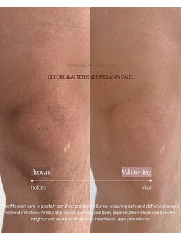 ビューティーホームサロン(Beauty Home Salon)/THE★MELANIN