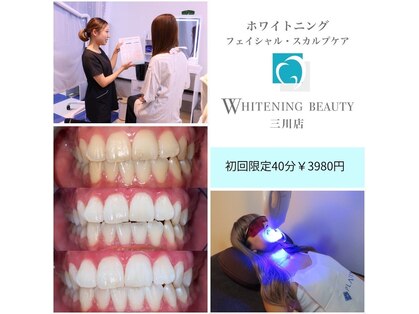 ホワイトニングビューティ 三川店の写真