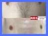 【メンズ腕、足など大きい範囲パーツ脱毛】1部位4,700円