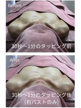 チュラ 大宮店(Chura)/1分で左右差が簡単に改善(2/2)