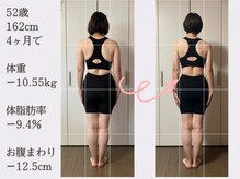 香林(KARIN)/ビフォーアフター