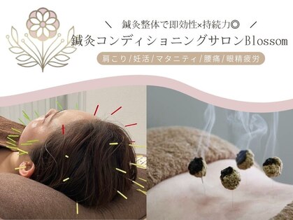 ブロッサム(Blossom)の写真