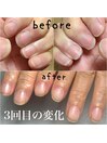 自爪育成/自爪風/3回目の変化