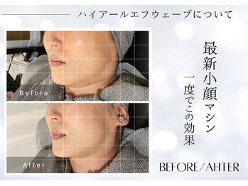 ユアーズ ビューティー(YOURS beauty)/1回で驚きの小顔へ☆