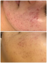 サロン エム(Salon M)/ハーブでセンシティブケア