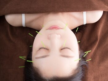 くにたちNyan鍼灸整体院の写真/【小顔矯正+美容鍼¥6,980】スッキリ引き上げる手技と美容鍼で美小顔へ!お顔の印象が変わる贅沢ダブルケア!!
