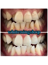 ホワイトニングショップ 葵区静岡駅店/ホワイトニング店ホワイトニング