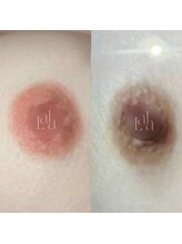 カルム(Calme)/Lalapink