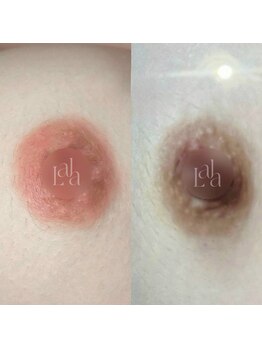 カルム(Calme)/Lalapink