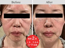 アールーム(Room)/