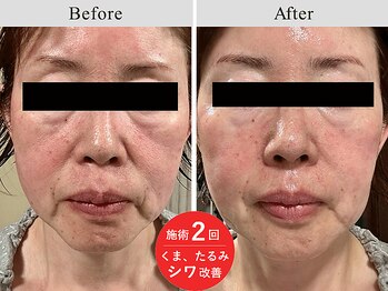 アールーム(Room)/