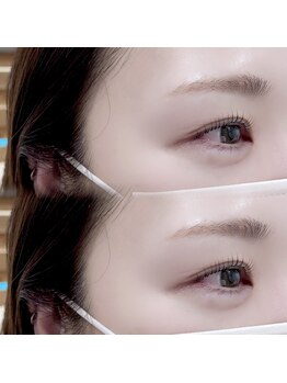 アイビーアイラッシュ(IVY EYELASH)/