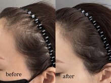 マレナスパ(Marena .spa)の雰囲気（頭皮に自然な毛根を描き、生え際のお悩みを目立ちにくくします。）