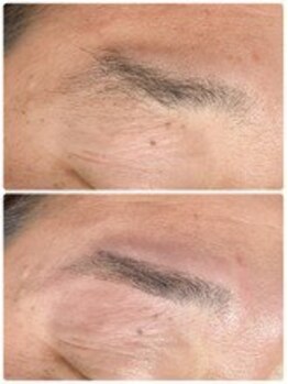 リルモナ(RIREMONA)/