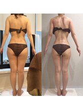 ボディベルム(BODY BELM)/全身土台作り