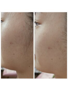 エターナル(Eternal)/肌のトーンUP