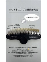 エクシアホワイトニング 札幌中島公園店/豆知識［ホワイトニング］