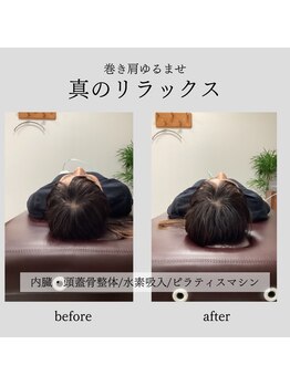 整体院 バイオリハ(Bio_Reha.)/【巻き肩】