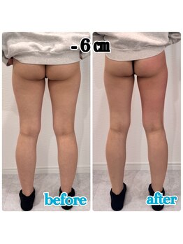 ボニート 堺東店(BONITO)/下半身エルフィーノ