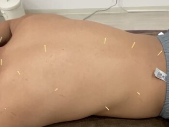 はりきゅう漫々の写真/筋肉を育てるには、休ませること・整えることも大切です◎血流や神経のバランスを整え、回復力をサポート。