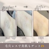 モアトゥインクル 東広島西条店(MORE twinkle)