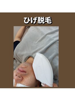 イージープラス つくば店(EASY+)/ひげ脱毛