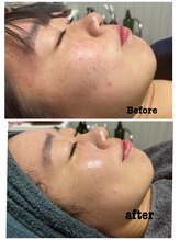 アスピリア(aspirer a')/老廃物もスッキリ！石膏パック◎